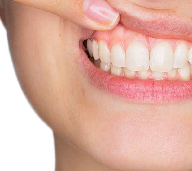 Des Plaines Gum Disease