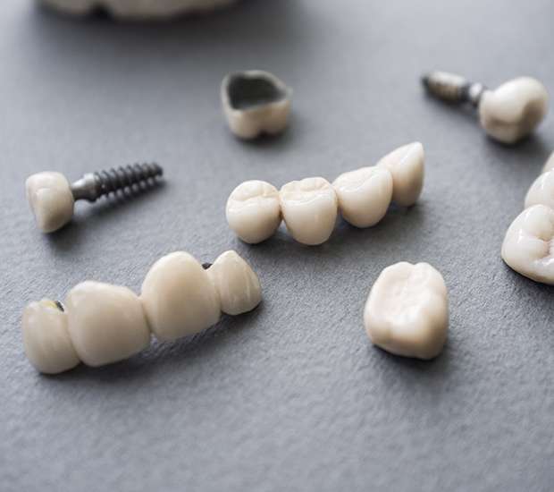 Des Plaines The Difference Between Dental Implants and Mini Dental Implants